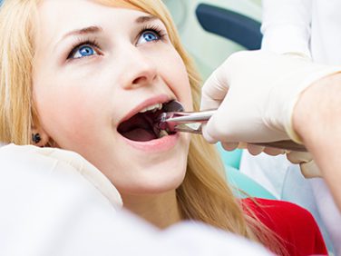 system_images_services_dental_interior_extractions_extractions2